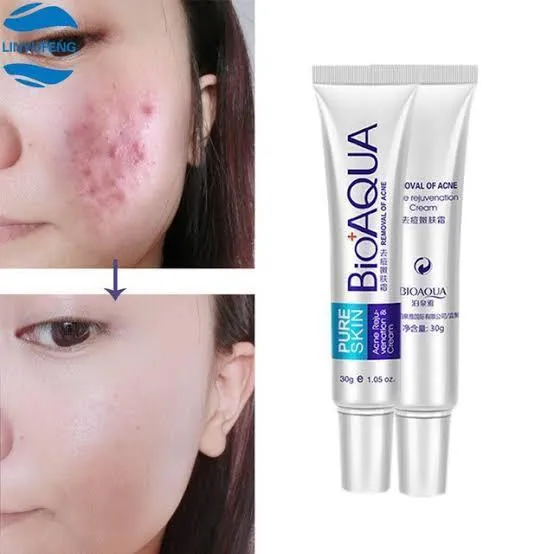 Premium Acne Removal Cream 30g All Skin Types